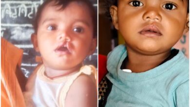 शासन की योजना से दूर हुई बेटी के भविष्य की चिंता, चिरायु दल ने लौटाई मासूम रंजना की मुस्कान…